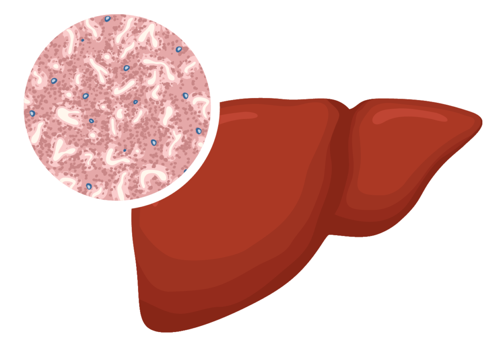 Infographic of a healthy liver