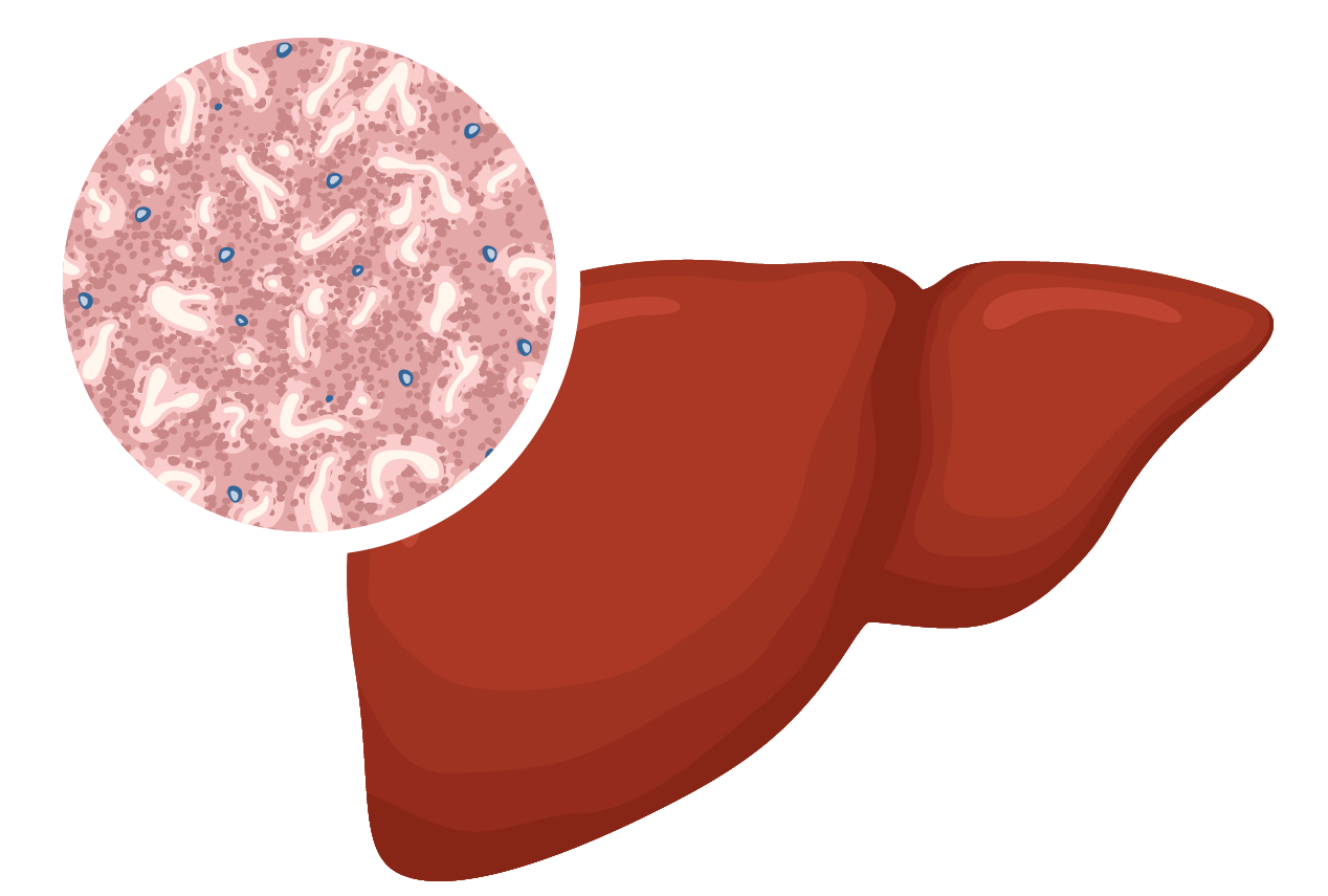 Infographic of a healthy liver